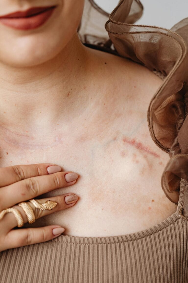 Body Positive Boudoir Photography Close-up of a woman's chest featuring a visible scar, highlighting fashion and personal expression.