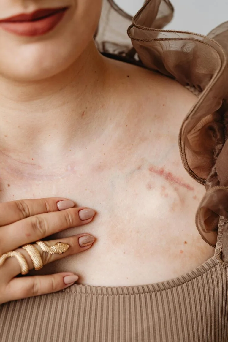 Body Positive Boudoir Photography Close-up of a woman's chest featuring a visible scar, highlighting fashion and personal expression.